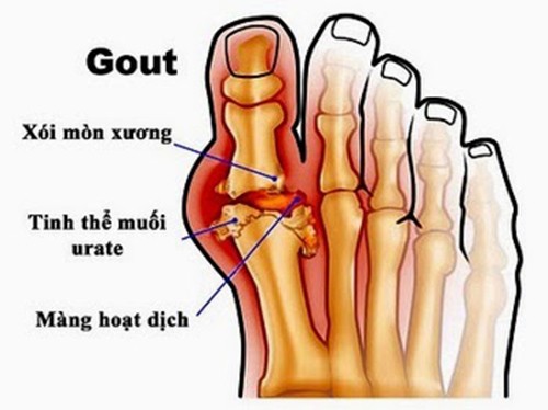 Ở TP.HCM có bao nhiêu địa điểm khám bệnh Gout?
