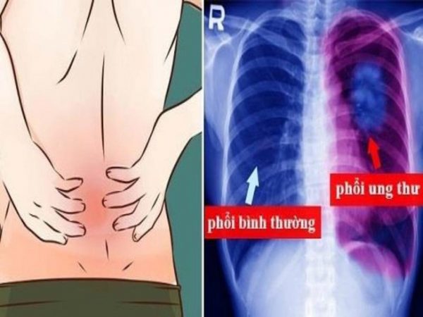 Khi nào cần tìm sự tư vấn y tế từ chuyên gia khi bị đau lưng dưới ở nam giới?