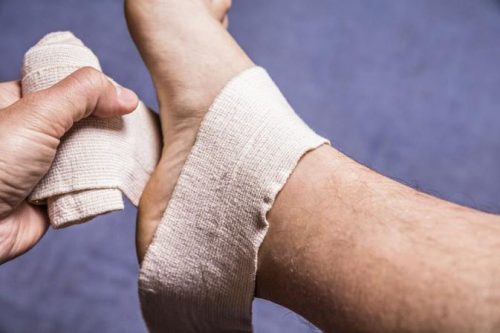 Đau xuất hiện khi vận động hay tải trọng lên bàn chân có phải là một dấu hiệu của xương bàn chân bị gãy?
