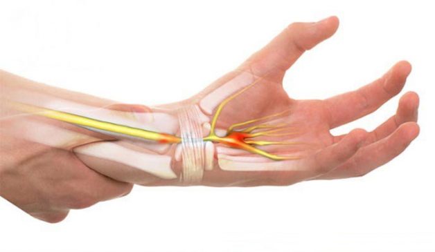 Các biện pháp điều trị và quản lý đau khớp cổ tay?
