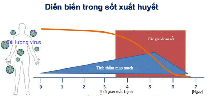 Điều trị sốt xuất huyết đau nhức xương khớp như thế nào?
