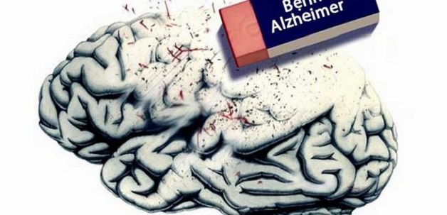 Khi nào cần điều chỉnh kế hoạch chăm sóc người bệnh Alzheimer? 
