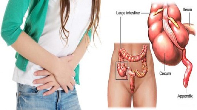 Nếu bị viêm phúc mạc, có thể cảm thấy khó chịu ở vùng bụng khắp không?
