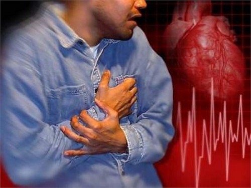 Có những biện pháp chăm sóc và quản lý nào dành cho những người đã và đang mắc nhồi máu cơ tim và đột quỵ?