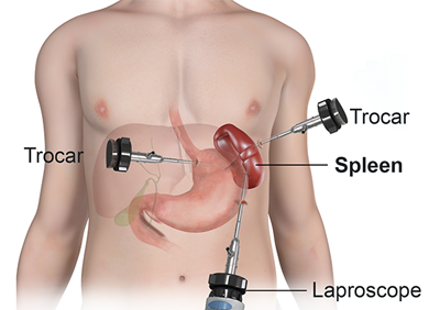 Tại sao lá lách được cho là vô dụng hoặc không đáng kể đến sự tồn tại của chúng ta?
