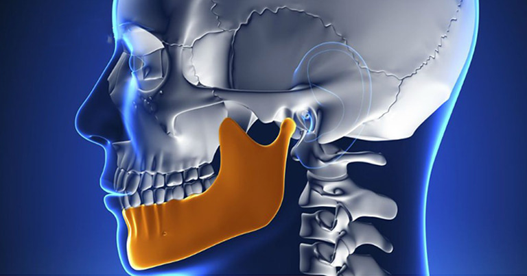 Có những nguyên nhân nào gây gãy xương hàm dưới và những triệu chứng nổi bật để nhận biết?
