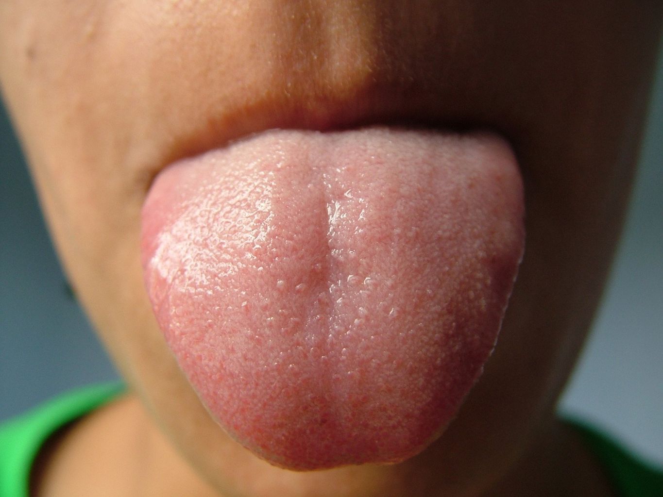 Màu sắc của lưỡi báo hiệu điều gì? | BvNTP