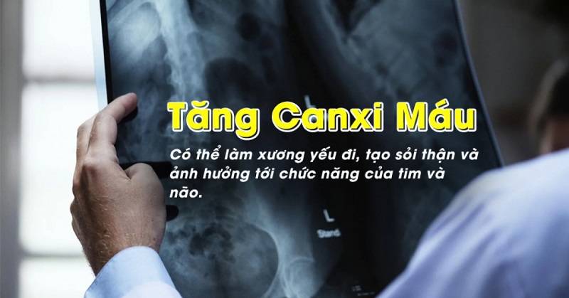 Các nhóm người có nguy cơ cao bị tăng canxi máu là ai? (Ví dụ: người già, phụ nữ mang thai, người mắc bệnh tuyến giáp...)
