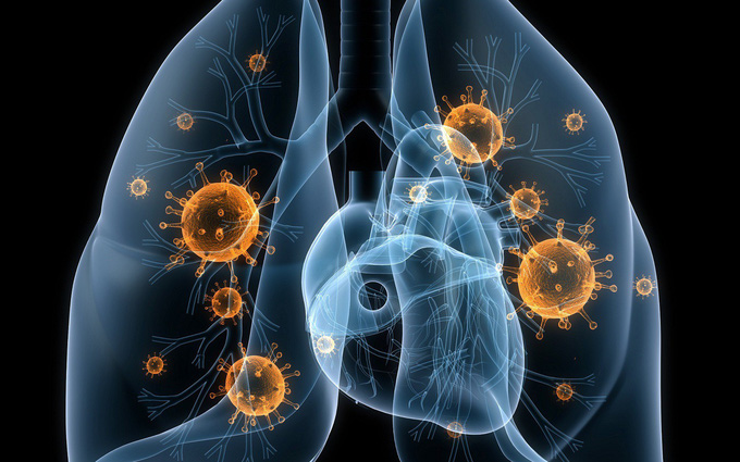 Viêm phổi hít là gì và điều trị thế nào | BvNTP