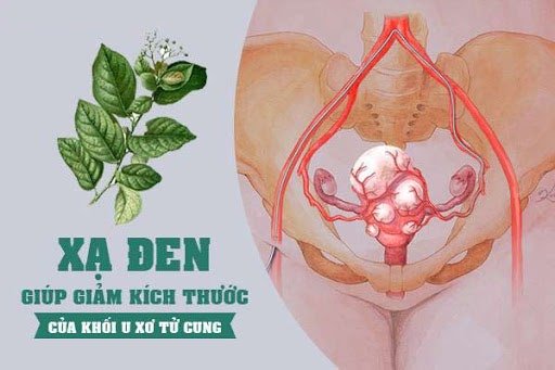 How to treat uterine fibroids using traditional Vietnamese medicine (đông y)?