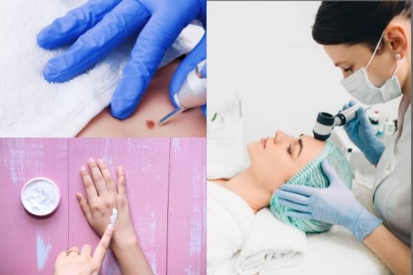 Hand eczema có những triệu chứng như thế nào?
