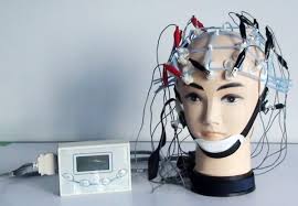 Giải thích rõ ràng về quy trình đo điện não đồ của bộ y tế bạn cần biết