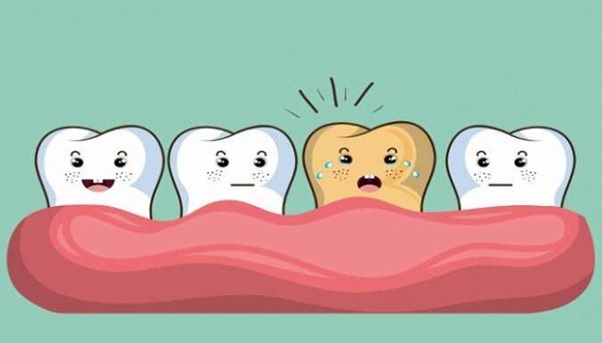 Cấu trúc răng hàm  Khám phá 3 chức năng chính của răng  Up Dental