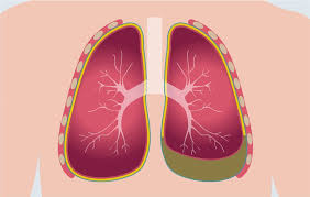 Có những biện pháp phòng ngừa tương tự cho viêm phế quản và viêm phổi không?
