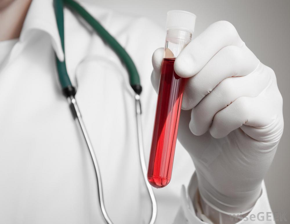 Công thức máu toàn bộ | BvNTP