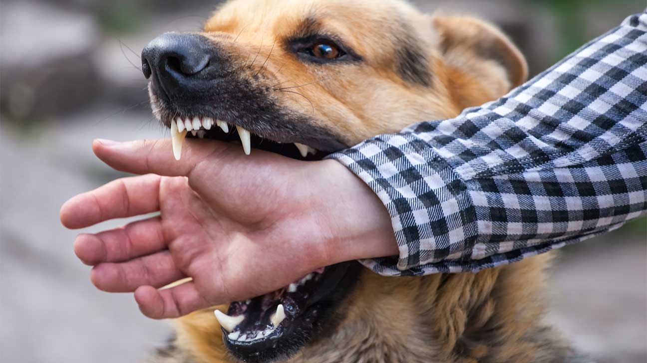 Tìm hiểu về vết thương chó cắn bị nhiễm trùng 