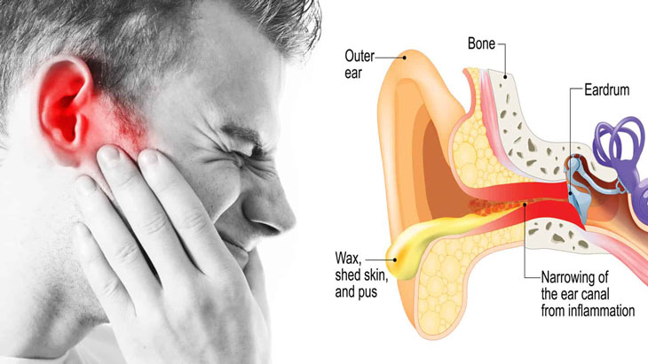 7 bệnh về tai phổ biến nhất