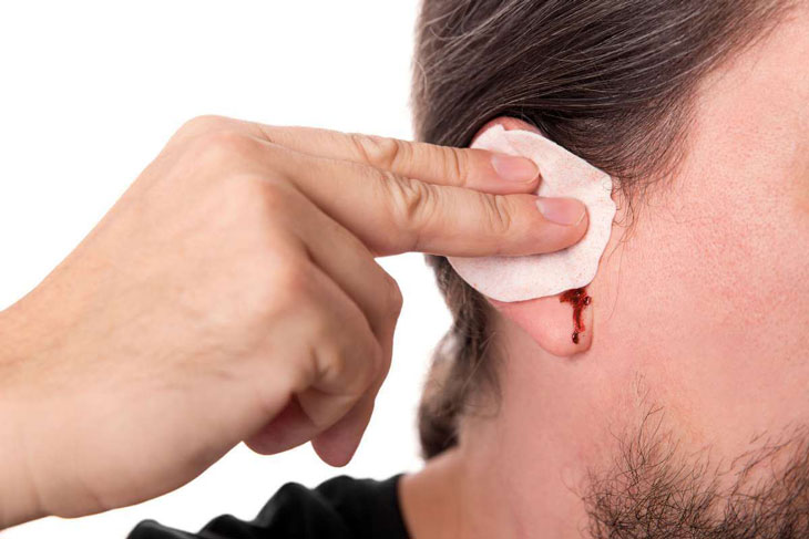 Chảy máu tai có nguy hiểm không? | BvNTP