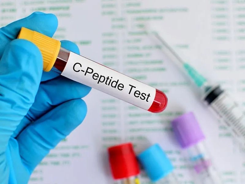C peptide được tổng hợp trong cơ thể như thế nào?