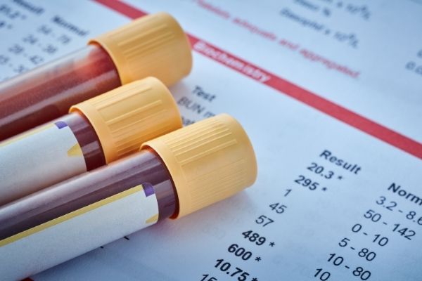 Vai trò của xét nghiệm đánh giá chức năng gan trong chẩn đoán và theo dõi bệnh lý gan mật | BvNTP