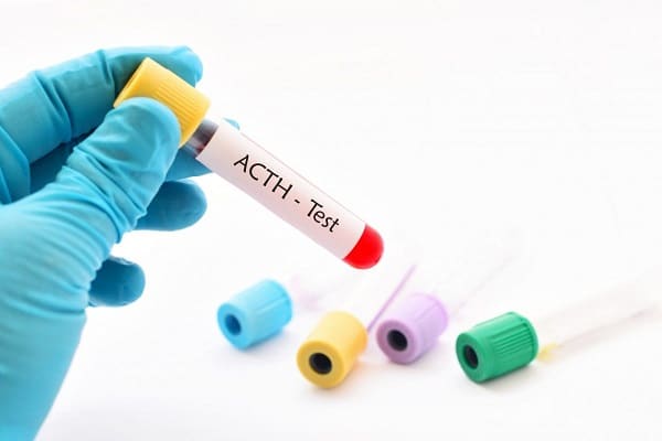 Xét nghiệm ACTH: ý nghĩa lâm sàng | BvNTP
