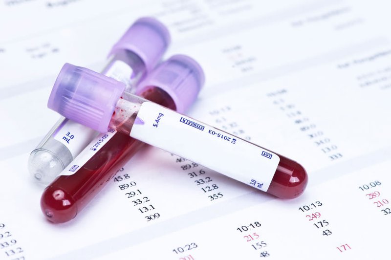 Làm thế nào để điều chỉnh chỉ số PDW trong máu?
