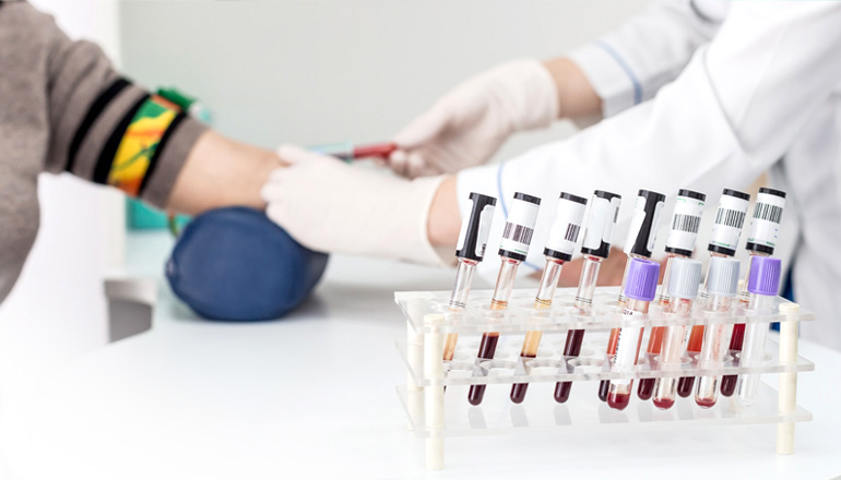 Các chỉ số xét nghiệm máu quan trọng trong xét nghiệm sinh hóa máu | BvNTP