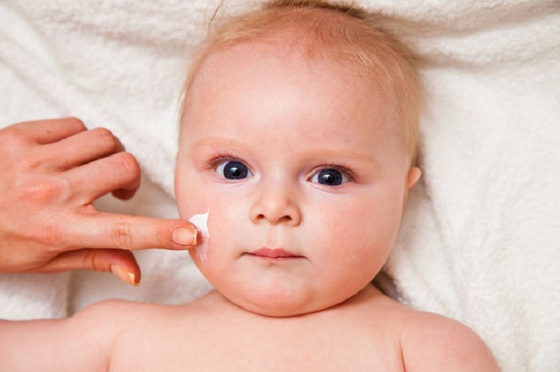 Làm thế nào để chăm sóc và điều trị mụn chàm sữa ở trẻ sơ sinh?
