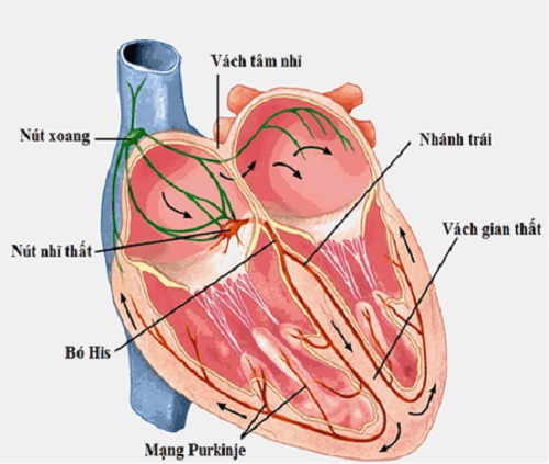 Liên quan giữa block nhánh và các vấn đề tim mạch khác như tiếng tim không đều, nhồi máu cơ tim, hay nhồi máu đồng thời của các phần tử dẫn truyền điện?
