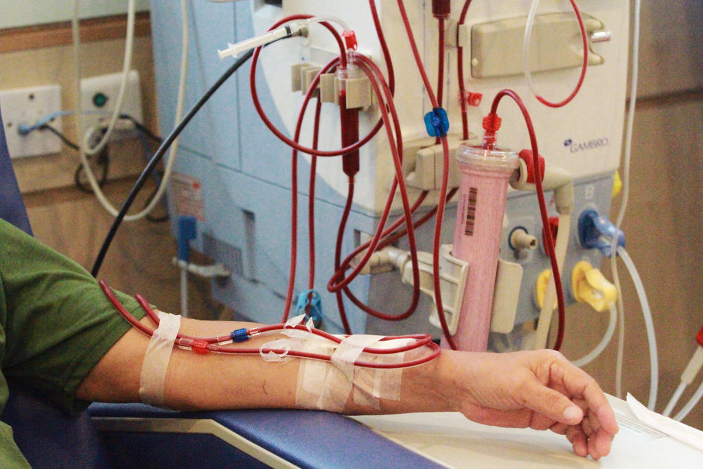 Chạy thận – lọc máu | BvNTP – Bệnh viện Nguyễn Tri Phương