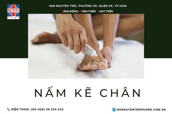 Điều trị hiệu quả bệnh ngứa kẽ chân?
