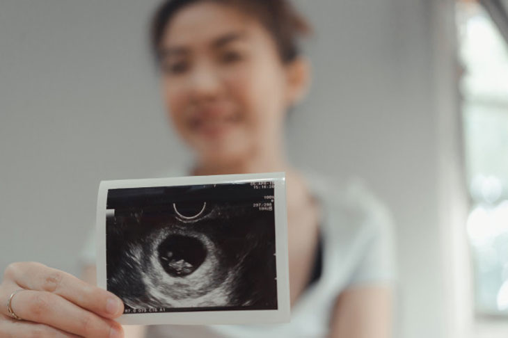 Nếu không kiêng cữ sau hút thai, có thể gây ảnh hưởng đến khả năng mang thai sau này không?
