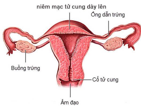 Độ dày niêm mạc tử cung có ảnh hưởng đến thụ thai không? | BvNTP