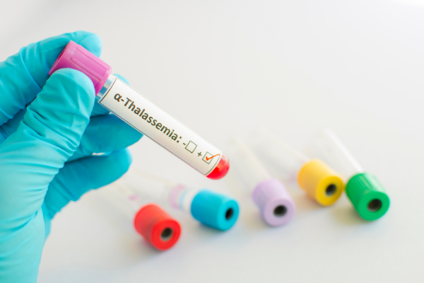 Những xét nghiệm nào được sử dụng trong quá trình sàng lọc thalassemia? 
