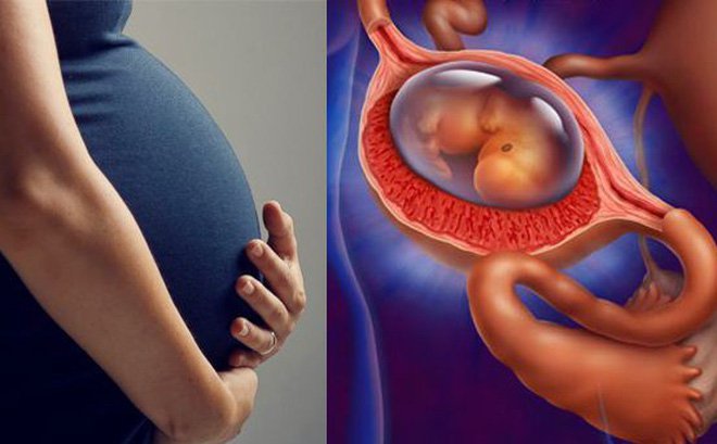 các dấu hiệu của thai ngoài tử cung