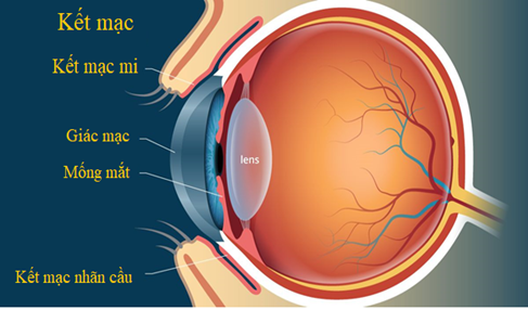 các bệnh về mắt khi bị viêm da cơ địa