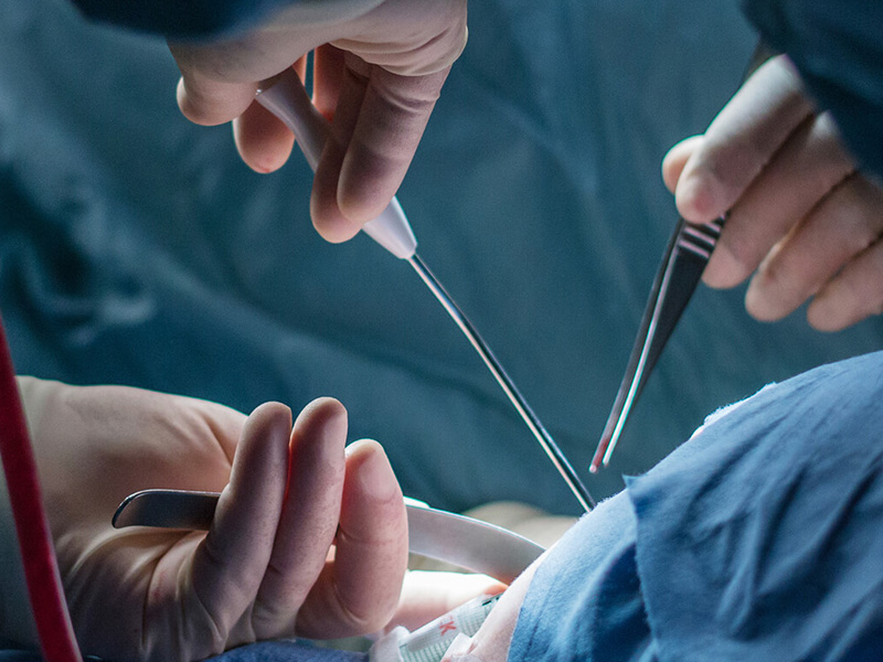 phẫu thuật tạo hình tuyến vú
