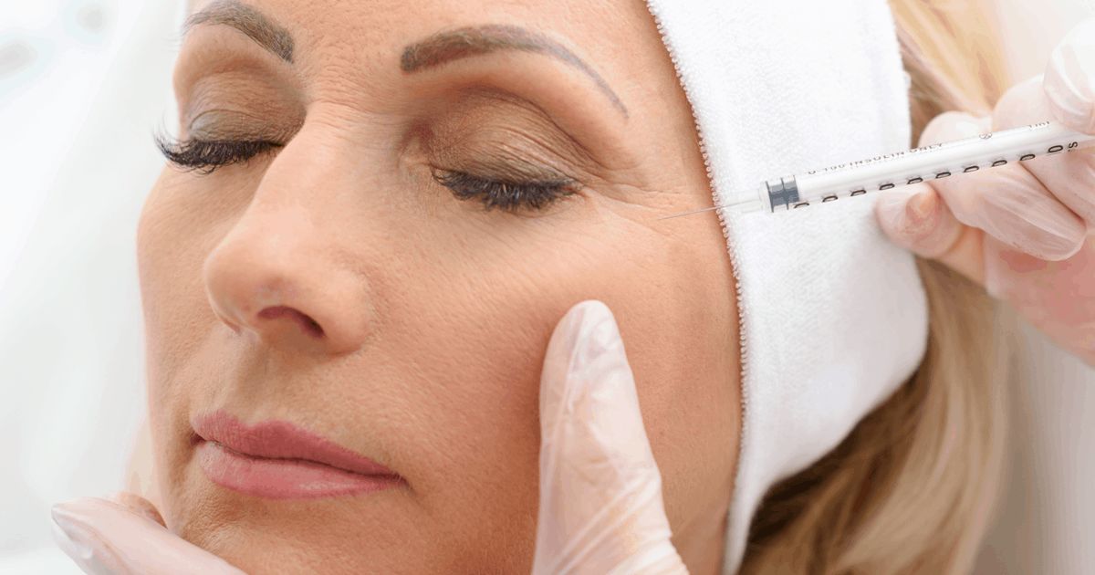 tiêm botox căng da mặt