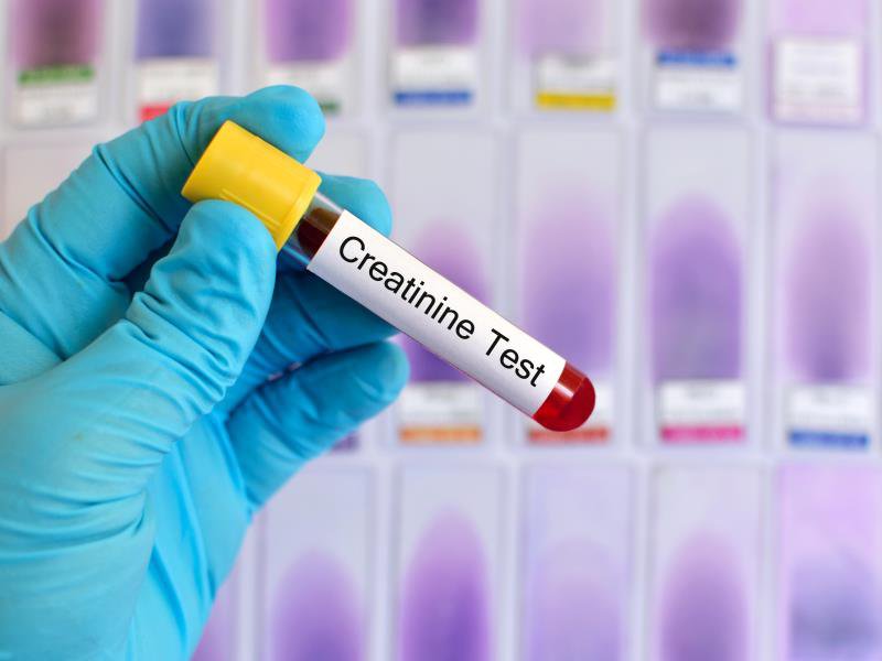 xét nghiệm creatinin máu